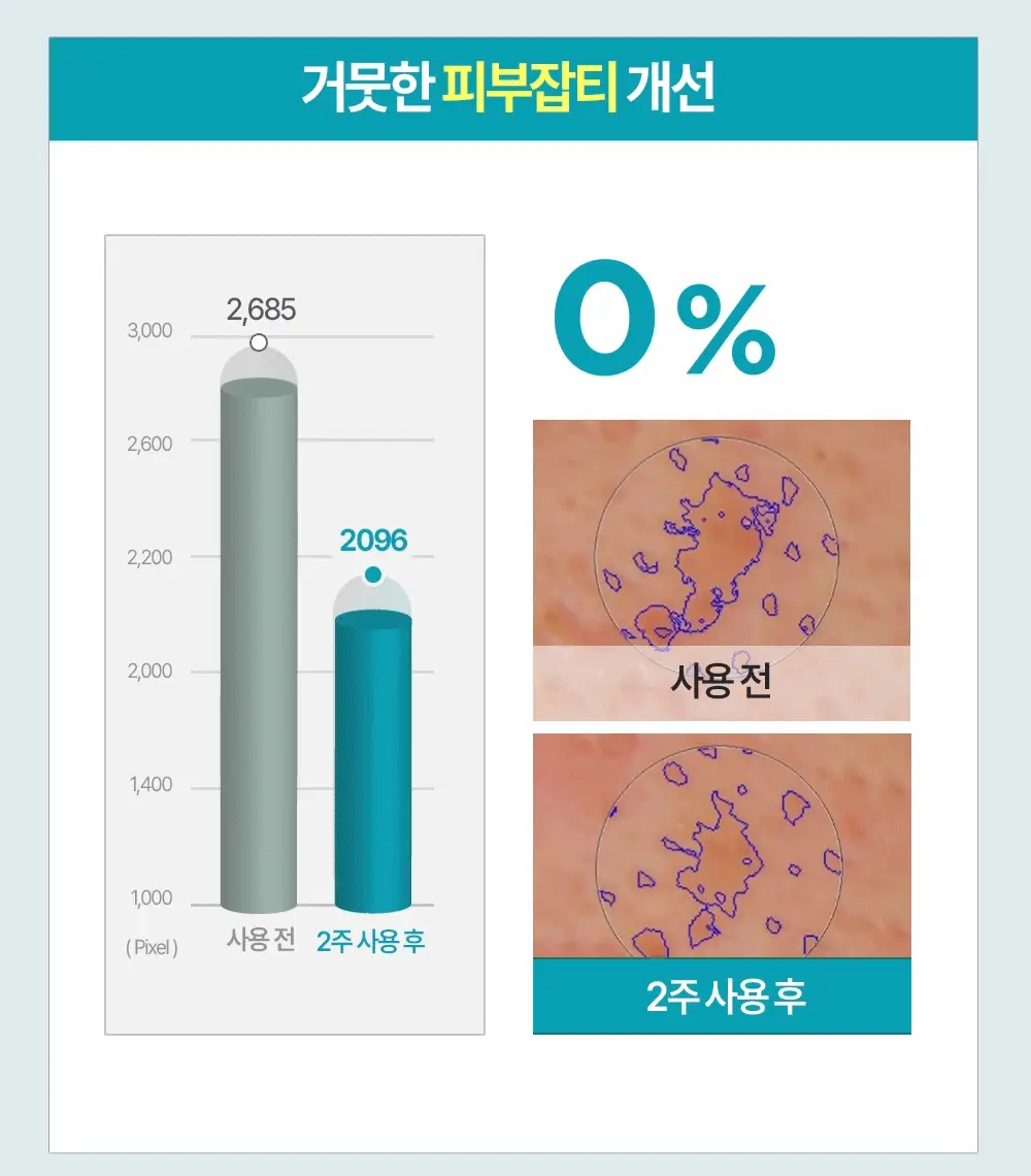 [열감진정] 더마토리 시카 엑소좀 흔적 진정 거즈 토너패드 70매+10매 기획 상세페이지 28